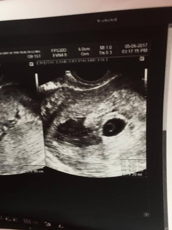 18601266_1438826752804696_1800891345_n